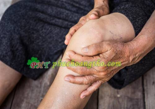 Điều trị thoái hóa khớp gối - Bài thuốc 1